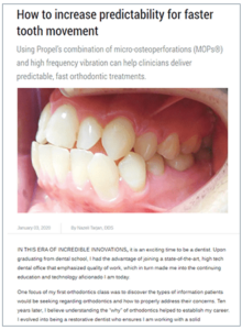 How to increase predictability for faster tooth movement 1